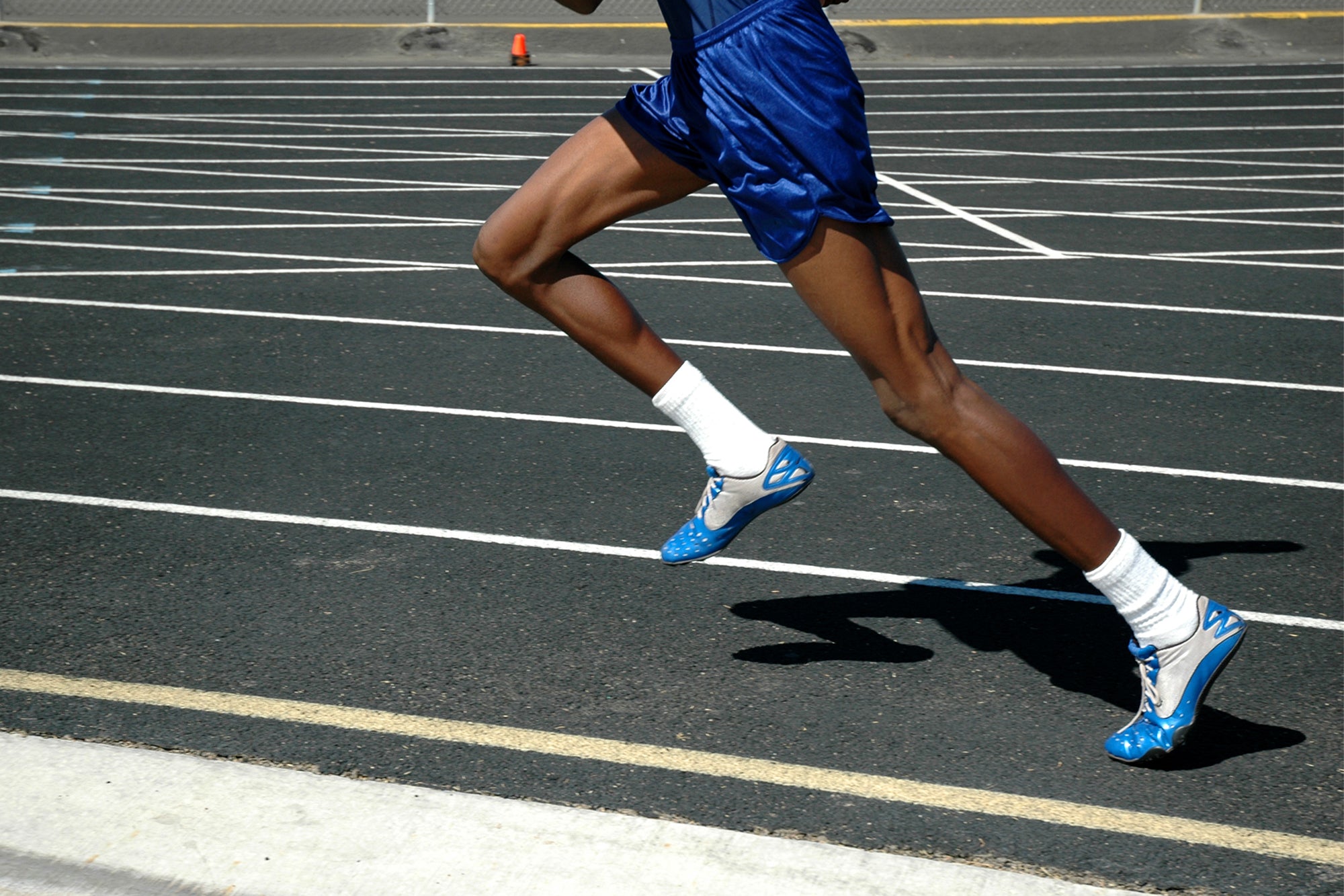 Biopods helped put an end to disabling shin splints.